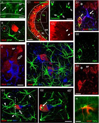 An Overview on the Differential Interplay Among Neurons–Astrocytes–Microglia in CA1 and CA3 Hippocampus in Hypoxia/Ischemia